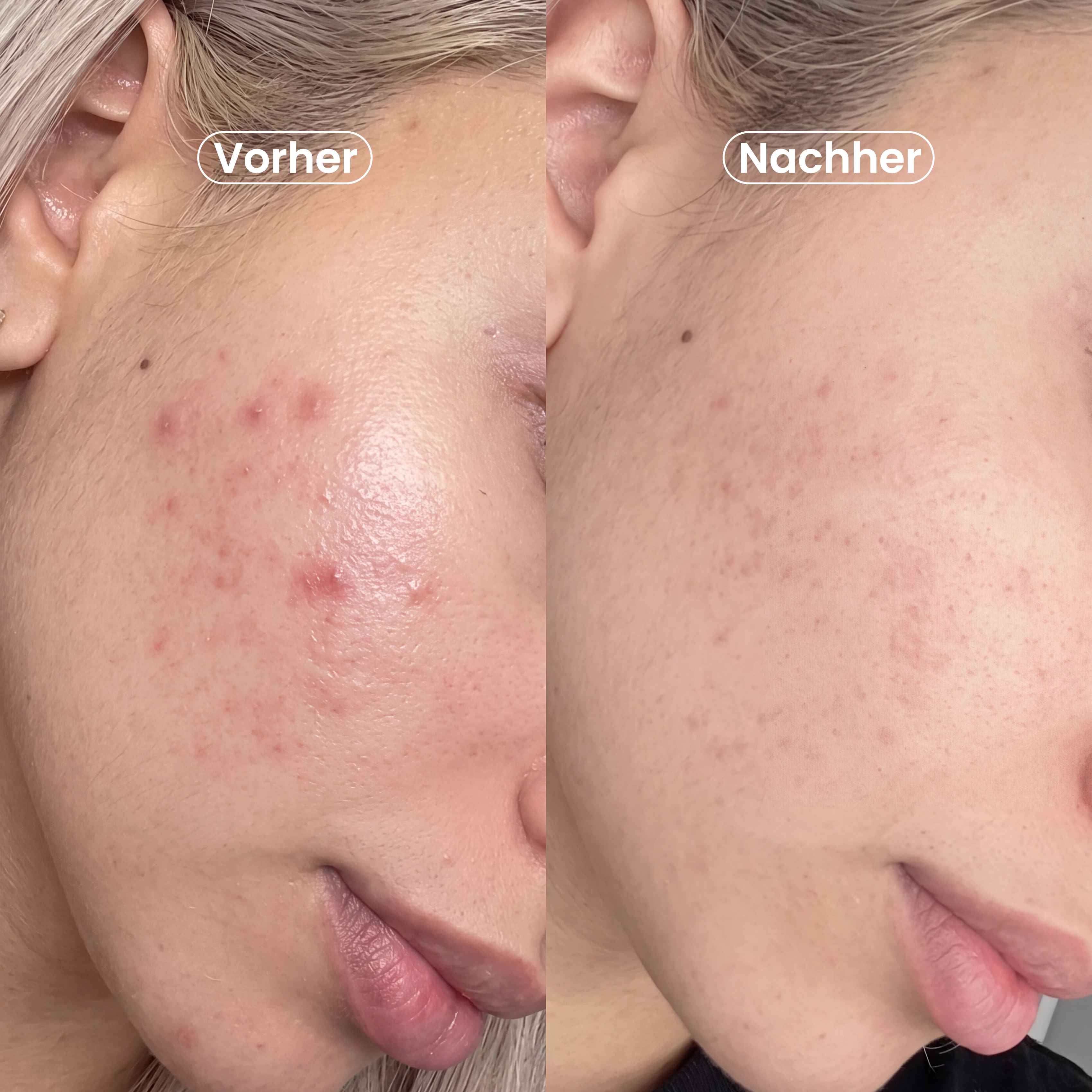 Spicule Boost Serum 300