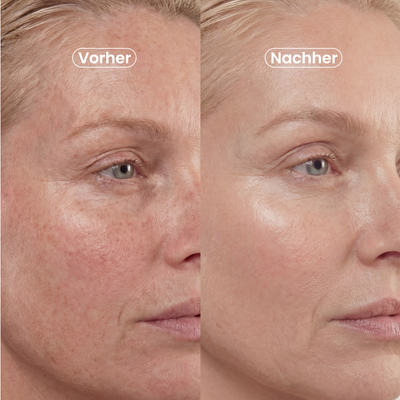Age-Defying Serum