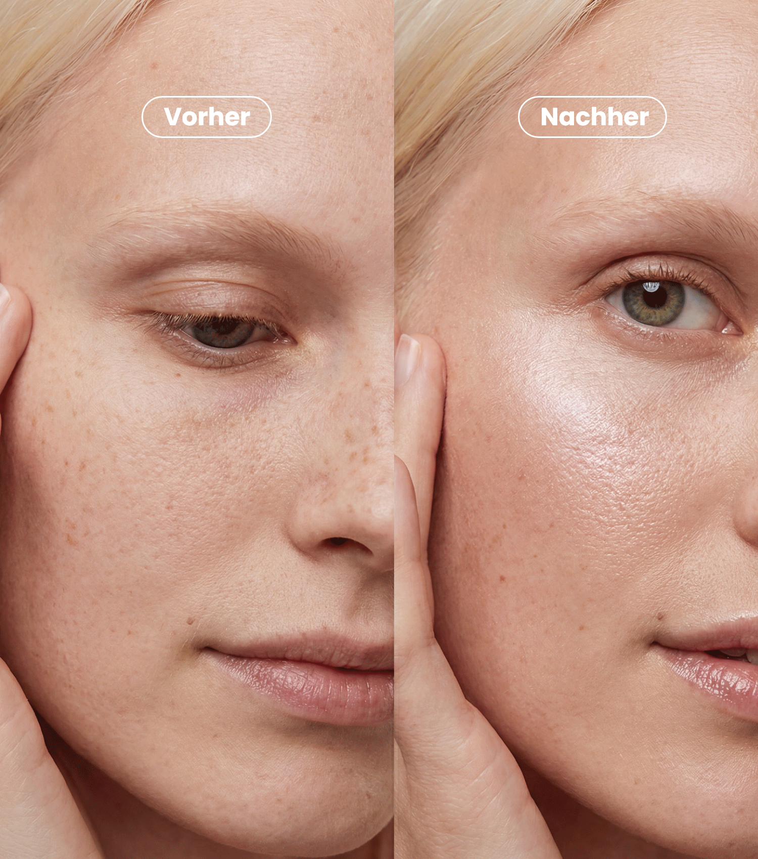 PDRN Intense Repair Cream