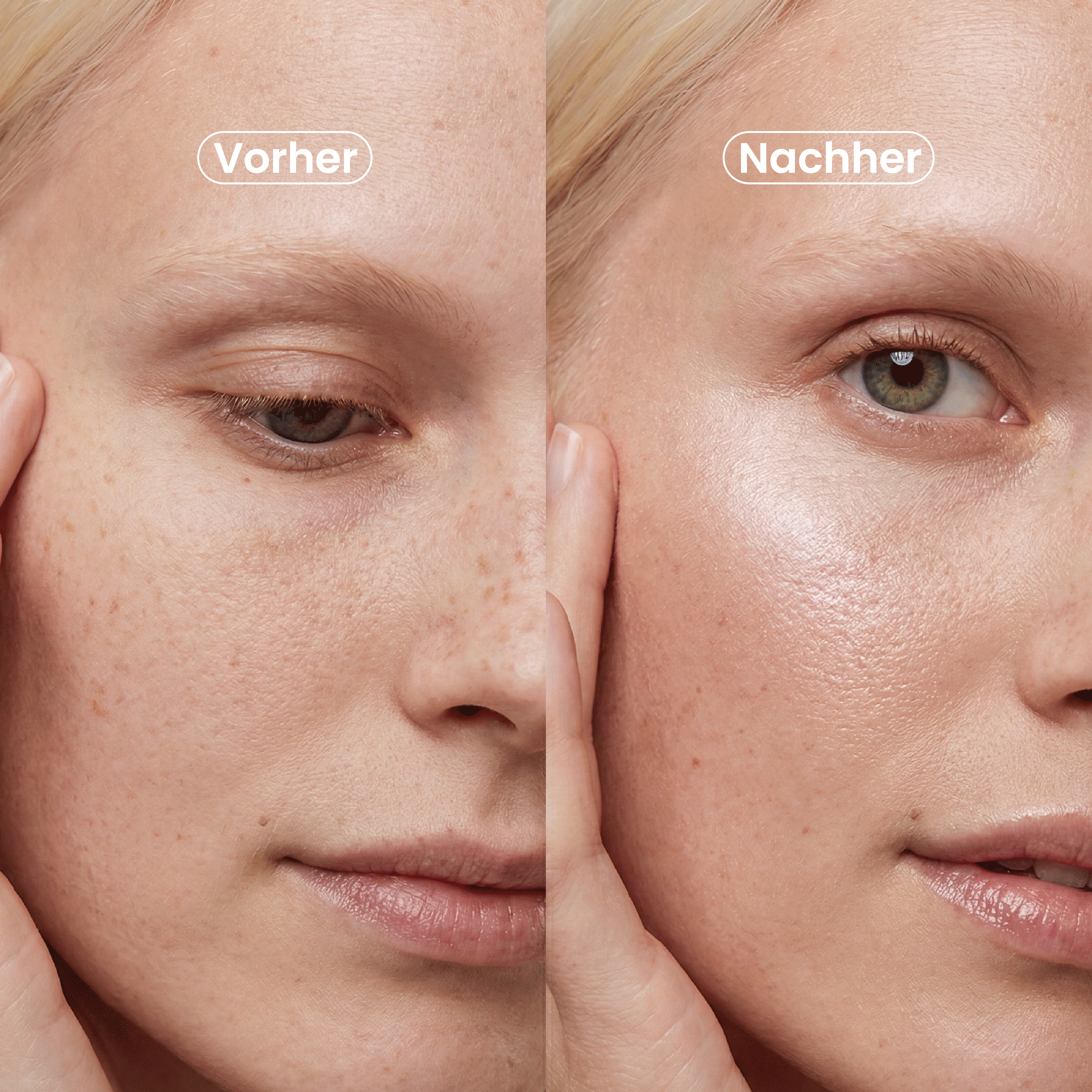 PDRN Intense Repair Cream